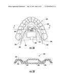 INTRA-ORAL ELECTRONIC THERAPY DEVICES FOR TREATMENT OF SLEEP-BREATHING DISORDERS, BRUXING DISORDERS, AND TMJ DISORDERS, AND ASSOCIATED METHODS diagram and image