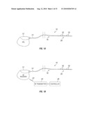 STIMULATION SYSTEM AND METHOD TREATING A NEUROLOGICAL DISORDER diagram and image