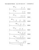 STIMULATION SYSTEM AND METHOD TREATING A NEUROLOGICAL DISORDER diagram and image