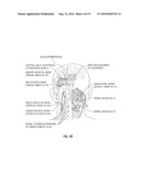 STIMULATION SYSTEM AND METHOD TREATING A NEUROLOGICAL DISORDER diagram and image