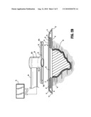 Negative Pressure and Electrostimulation Therapy Apparatus diagram and image