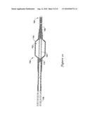 STENT DELIVERY CATHETER diagram and image