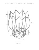 TWO-STAGE COLLAPSIBLE/EXPANDABLE PROSTHETIC HEART VALVES AND ANCHORING SYSTEMS diagram and image