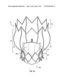 TWO-STAGE COLLAPSIBLE/EXPANDABLE PROSTHETIC HEART VALVES AND ANCHORING SYSTEMS diagram and image