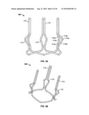 TWO-STAGE COLLAPSIBLE/EXPANDABLE PROSTHETIC HEART VALVES AND ANCHORING SYSTEMS diagram and image