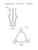 TWO-STAGE COLLAPSIBLE/EXPANDABLE PROSTHETIC HEART VALVES AND ANCHORING SYSTEMS diagram and image