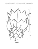 TWO-STAGE COLLAPSIBLE/EXPANDABLE PROSTHETIC HEART VALVES AND ANCHORING SYSTEMS diagram and image