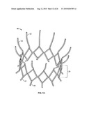 TWO-STAGE COLLAPSIBLE/EXPANDABLE PROSTHETIC HEART VALVES AND ANCHORING SYSTEMS diagram and image