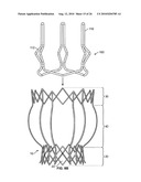 TWO-STAGE COLLAPSIBLE/EXPANDABLE PROSTHETIC HEART VALVES AND ANCHORING SYSTEMS diagram and image