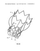 TWO-STAGE COLLAPSIBLE/EXPANDABLE PROSTHETIC HEART VALVES AND ANCHORING SYSTEMS diagram and image