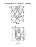 TWO-STAGE COLLAPSIBLE/EXPANDABLE PROSTHETIC HEART VALVES AND ANCHORING SYSTEMS diagram and image