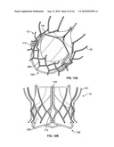 TWO-STAGE COLLAPSIBLE/EXPANDABLE PROSTHETIC HEART VALVES AND ANCHORING SYSTEMS diagram and image