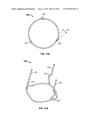 TWO-STAGE COLLAPSIBLE/EXPANDABLE PROSTHETIC HEART VALVES AND ANCHORING SYSTEMS diagram and image