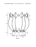 TWO-STAGE COLLAPSIBLE/EXPANDABLE PROSTHETIC HEART VALVES AND ANCHORING SYSTEMS diagram and image