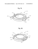 Single optic accommodative intraocular lens system diagram and image