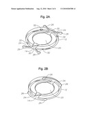 Single optic accommodative intraocular lens system diagram and image