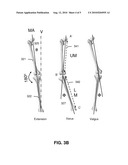 METHOD AND SYSTEM FOR POSITIONAL MEASUREMENT USING ULTRASONIC SENSING diagram and image