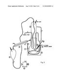 Process for the Preparation of Biodiesel from Vegetable Oils Containing High FFA diagram and image