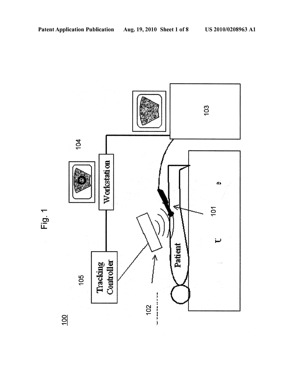 SYSTEM AND METHOD FOR FUSING REAL-TIME ULTRASOUND IMAGES WITH PRE-ACQUIRED MEDICAL IMAGES - diagram, schematic, and image 02