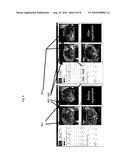 SYSTEM AND METHOD FOR FUSING REAL-TIME ULTRASOUND IMAGES WITH PRE-ACQUIRED MEDICAL IMAGES diagram and image