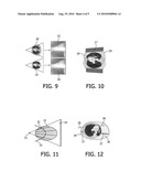 METHOD FOR ELIMINATING SCATTER ARTEFACTS diagram and image