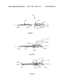 Pipette Device and Method of Manufacture and Use Thereof diagram and image