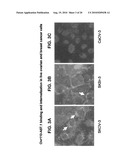 OVR110 Antibody Compositions and Methods of Use diagram and image