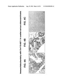 OVR110 Antibody Compositions and Methods of Use diagram and image