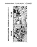 OVR110 Antibody Compositions and Methods of Use diagram and image