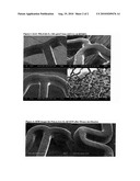 COATING COMPRISING A TERPOLYMER COMPRISING CAPROLACTONE AND GLYCOLIDE diagram and image