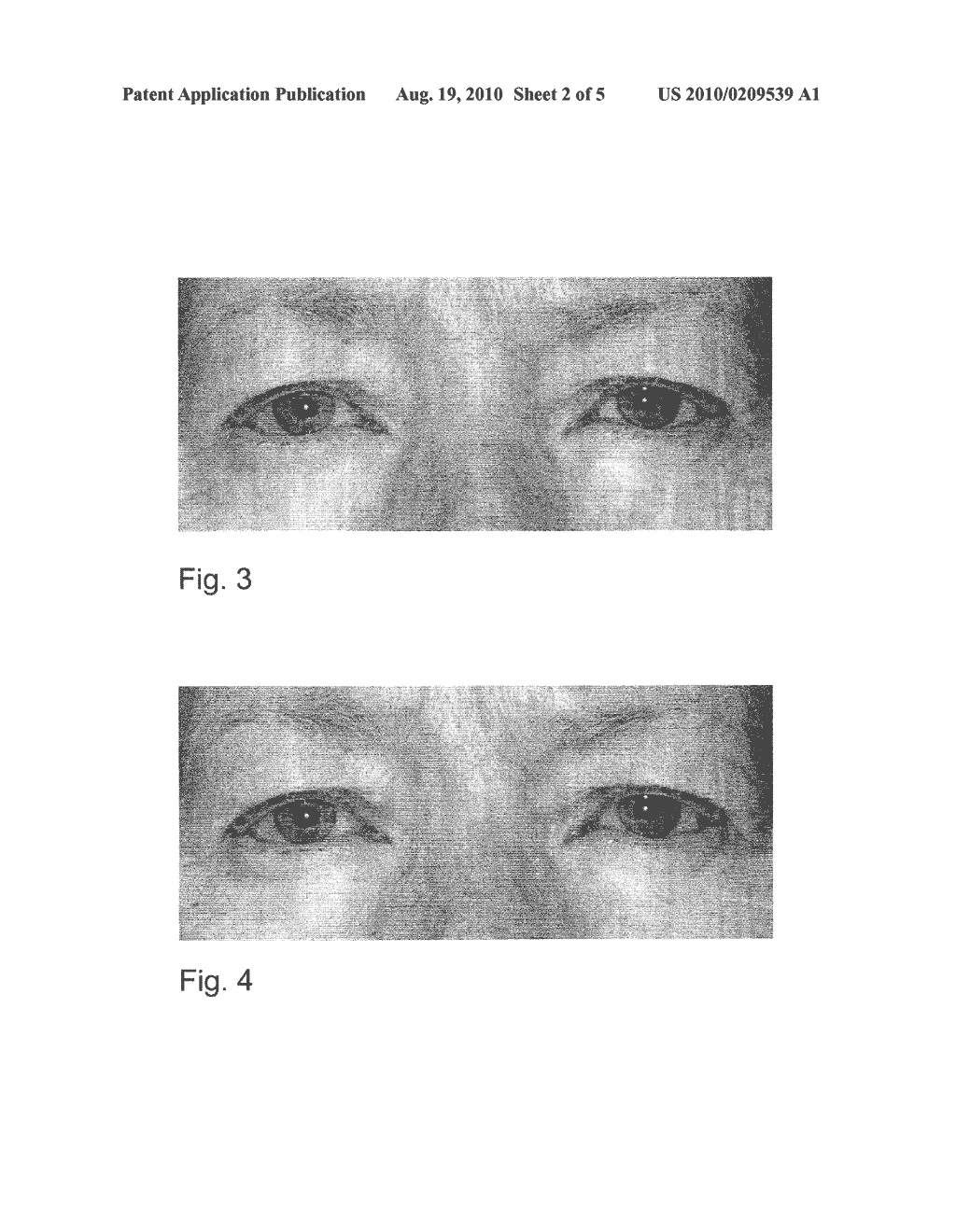 COMPOSITIONS AND METHODS OF USING SAME FOR TREATMENT OF A DISEASE OR DISORDER OF THE EYE AND/OR THE ADNEXA OF THE EYE - diagram, schematic, and image 03