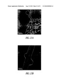 GROWTH OF COATINGS OF NANOPARTICLES BY PHOTOINDUCED CHEMICAL VAPOR DEPOSITION diagram and image