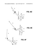 Training and Coordination Device diagram and image