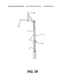 Integrated pole pad for sports support pole diagram and image