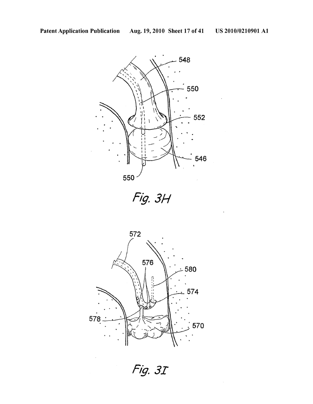 Devices, Systems and Methods For Diagnosing and Treating Sinusitis and Other Disorders of the Ears, Nose and/or Throat - diagram, schematic, and image 18