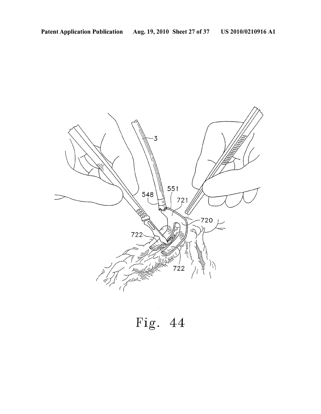 Surgical Instruments for Accessing and Stabilizing a Localized Portion of a Beating Heart - diagram, schematic, and image 28