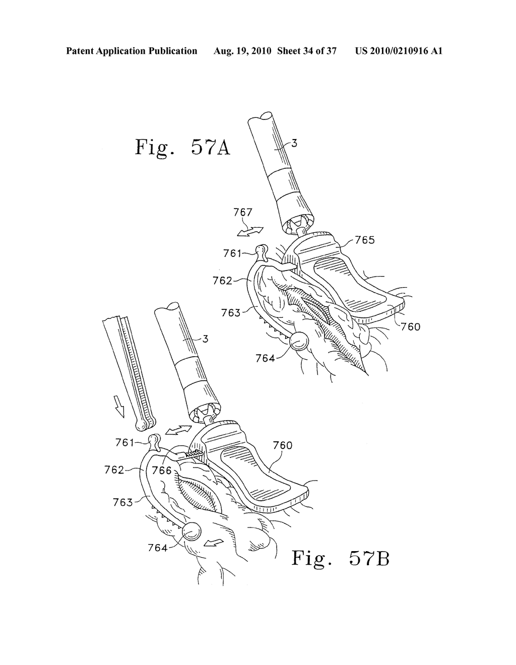 Surgical Instruments for Accessing and Stabilizing a Localized Portion of a Beating Heart - diagram, schematic, and image 35