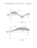 SYSTEMS AND METHODS FOR GRAPHIC DISPLAY OF ST-SEGMENT DEVIATION diagram and image