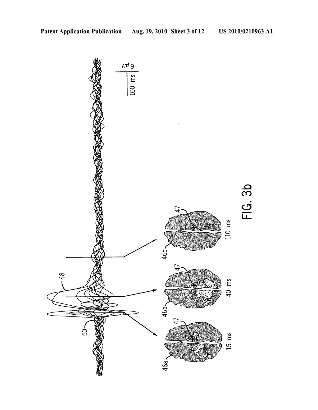 Method for assessing anesthetization - diagram, schematic, and image 04