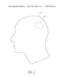 IMPLANTABLE SEIZURE MONITOR diagram and image