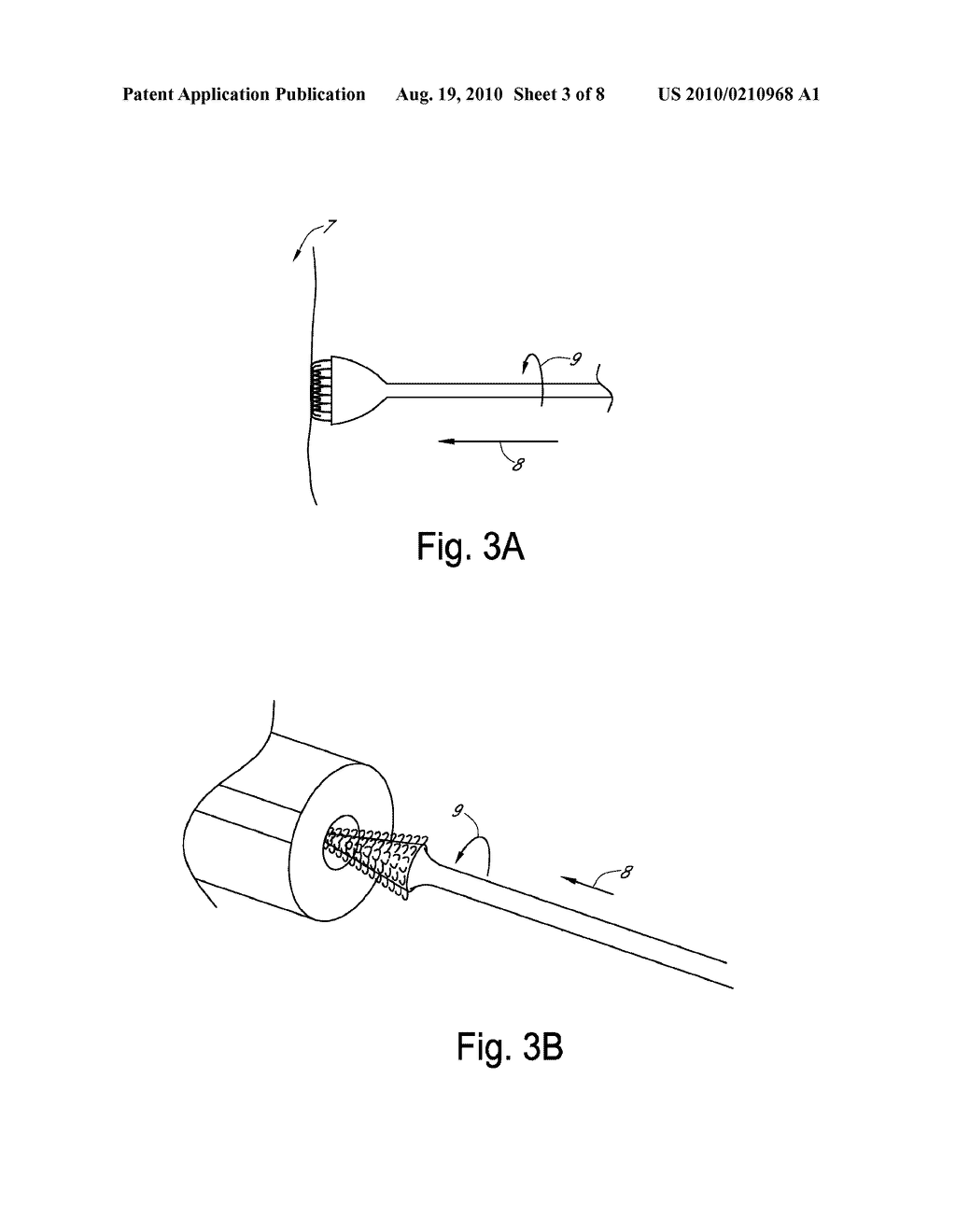 FRICTIONAL TRANS-EPITHELIAL TISSUE DISRUPTION AND COLLECTION APPARATUS AND METHOD OF INDUCING AND/OR AUGMENTING AN IMMUNE RESPONSE - diagram, schematic, and image 04