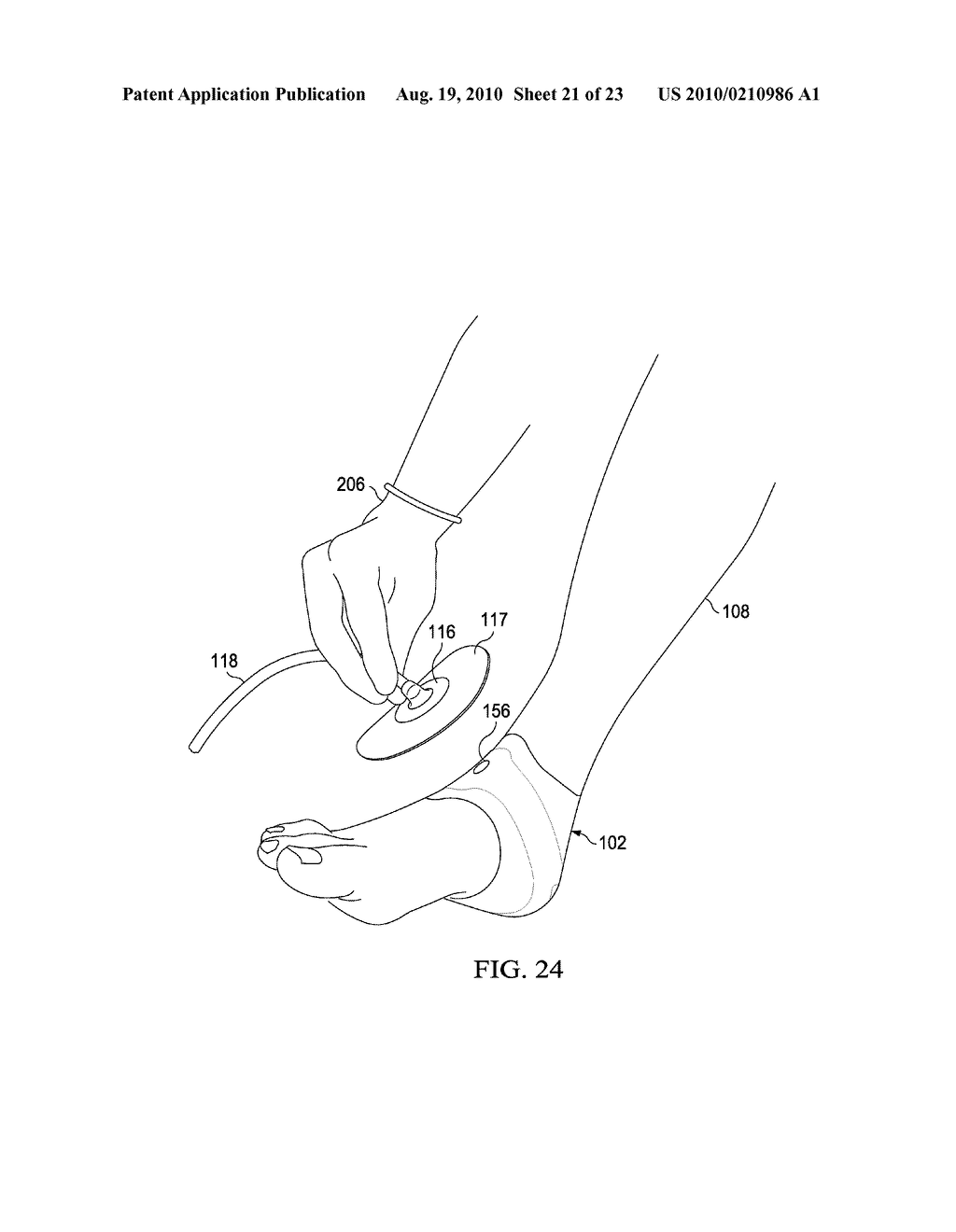 NEGATIVE PRESSURE WOUND TREATMENT DRESSINGS AND SYSTEMS - diagram, schematic, and image 22