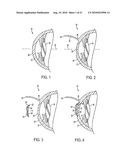 METHOD FOR LASER CORRECTION OF REFRACTIVE ERRORS OF AN EYE WITH A THIN CORNEA diagram and image