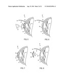 METHOD FOR LASER CORRECTION OF REFRACTIVE ERRORS OF AN EYE WITH A THIN CORNEA diagram and image