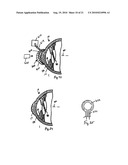 METHOD FOR LASER CORRECTION OF REFRACTIVE ERRORS OF AN EYE WITH A THIN CORNEA diagram and image