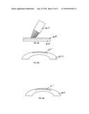 METHOD FOR LASER CORRECTION OF REFRACTIVE ERRORS OF AN EYE WITH A THIN CORNEA diagram and image