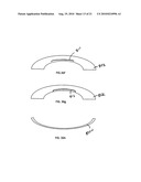 METHOD FOR LASER CORRECTION OF REFRACTIVE ERRORS OF AN EYE WITH A THIN CORNEA diagram and image