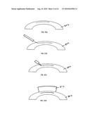 METHOD FOR LASER CORRECTION OF REFRACTIVE ERRORS OF AN EYE WITH A THIN CORNEA diagram and image