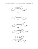 METHOD FOR LASER CORRECTION OF REFRACTIVE ERRORS OF AN EYE WITH A THIN CORNEA diagram and image