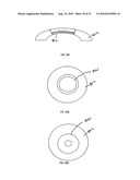 METHOD FOR LASER CORRECTION OF REFRACTIVE ERRORS OF AN EYE WITH A THIN CORNEA diagram and image